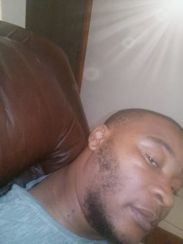 Customer photo review of Minoxidil High Strength (5%) FOAM, 3x60ml pack