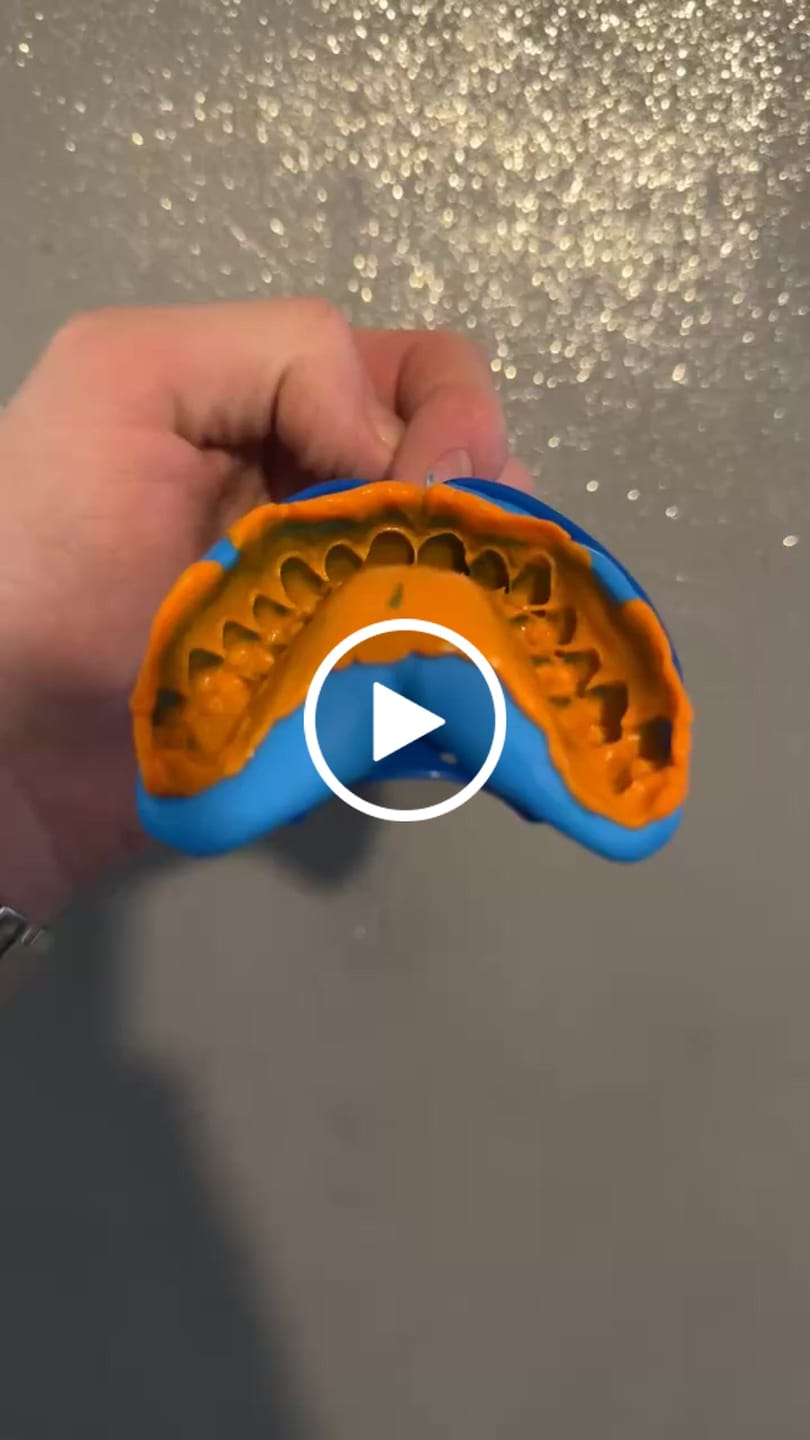 Customer video review of Upper Impression Kit