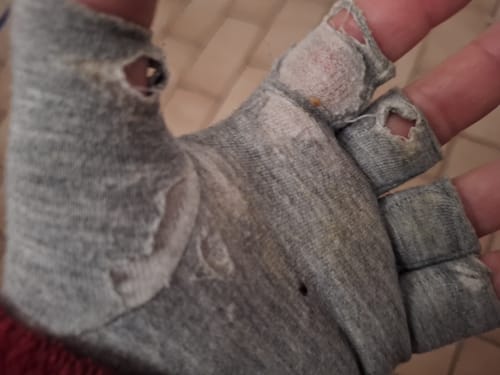 Customer photo review of BambuSleeve™ Kompressionshandskar