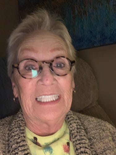 Customer smiling in a close-up photo to show the great fit and look of their Pop On Veneers.
