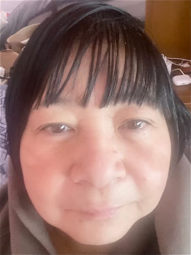 Close-up of a reviewer's face, showing her skin after using the Glov Micro Infusion System.