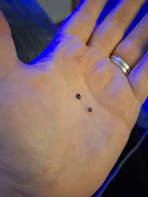 Customer photo review of Bőrkinövés Eltávolító Készlet