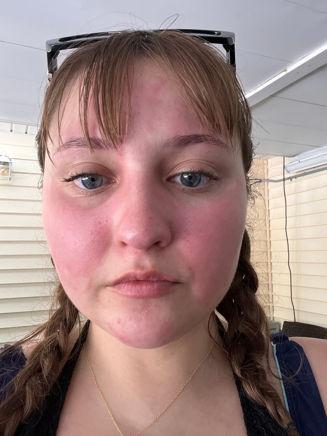 Customer photo review of Alcohol Flush and Hangover Reducer Capsules