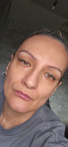 A reviewer's makeup-free face showing clear skin after using the Glov Micro Infusion System.