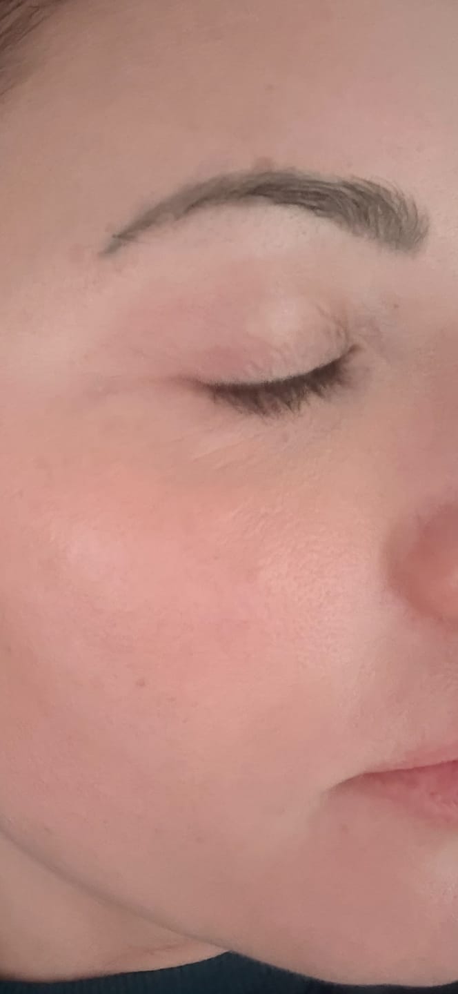 Customer photo review of The Naked Skin™ Bounce Balm