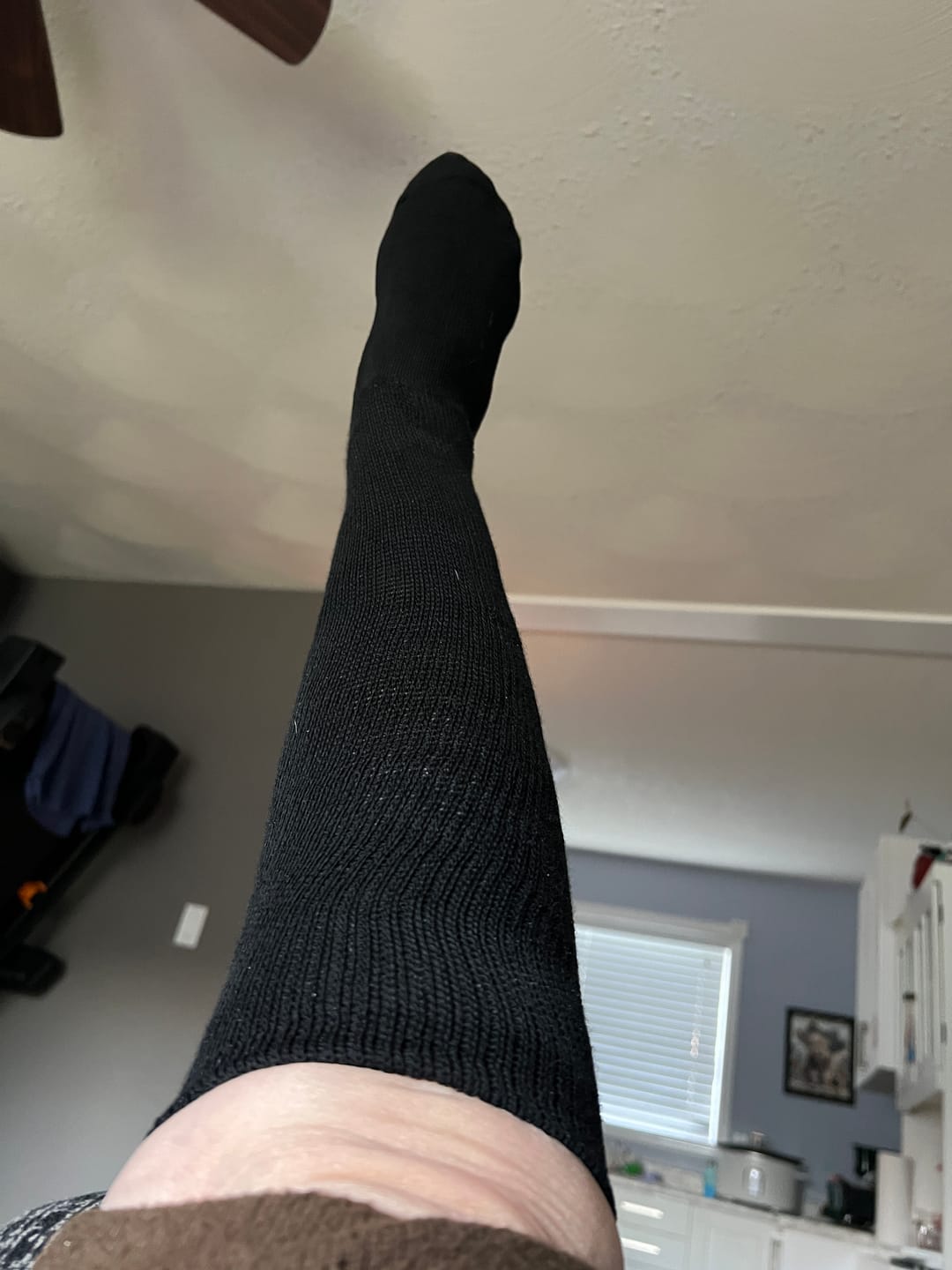 Customer photo review of Pet Garden Ankle Compression Socks 5-Pack Bundle