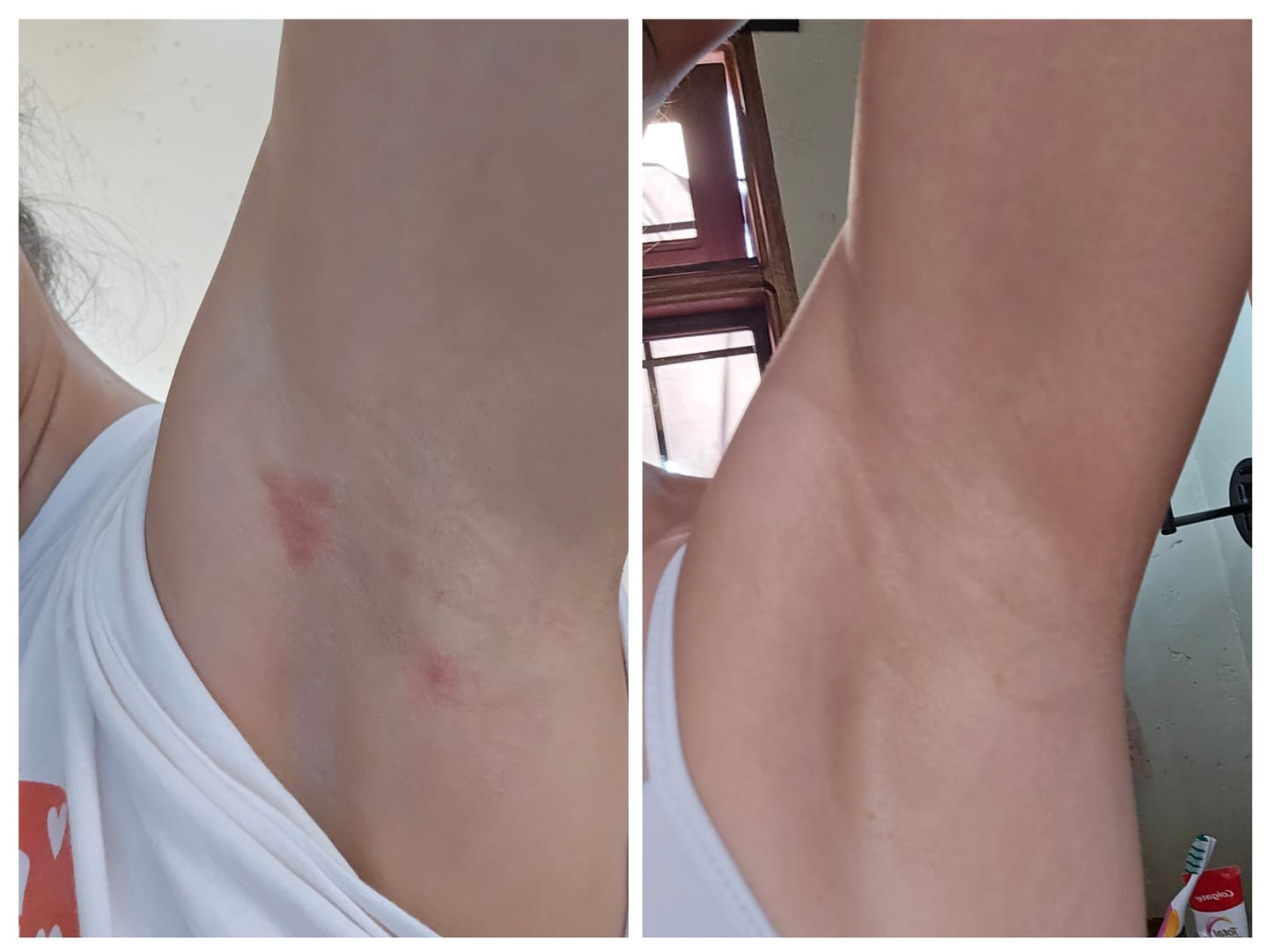 Customer photo review of Desodorante Natural Unisex
