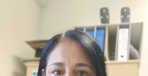 Customer photo review of Minoxidil High Strength (5%) SOLUTION, 3x60ml pack