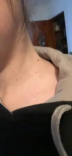 Customer photo review of Bőrkinövés Eltávolító Készlet
