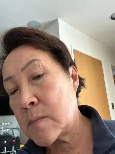 Customer photo review of Bőrkinövés Eltávolító Készlet