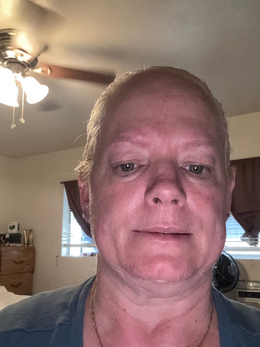 Customer photo review of DIVINE9 Facial Serum