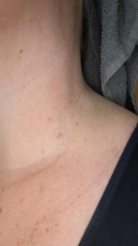 Customer photo review of Bőrkinövés Eltávolító Készlet