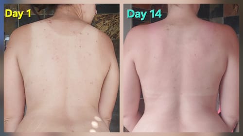 Customer photo review of Clear Skin Check