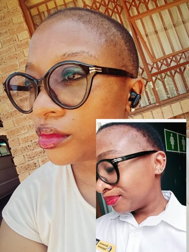 Customer photo review of Minoxidil High Strength (5%) SOLUTION, 3x60ml pack