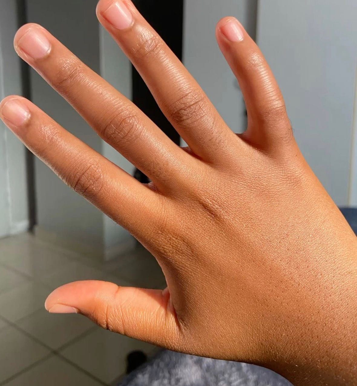 Customer photo review of SÉRUM CORRECTEUR CIBLÉ ANTI-QUINTOS