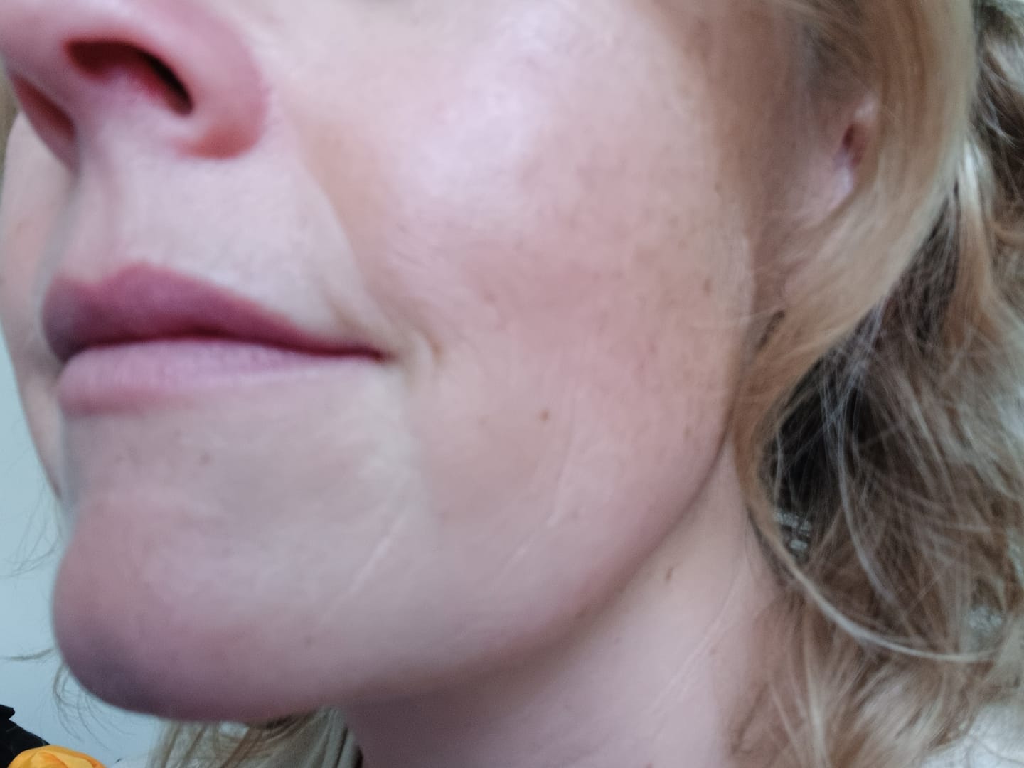 Customer photo review of Retinol Serum 30ml