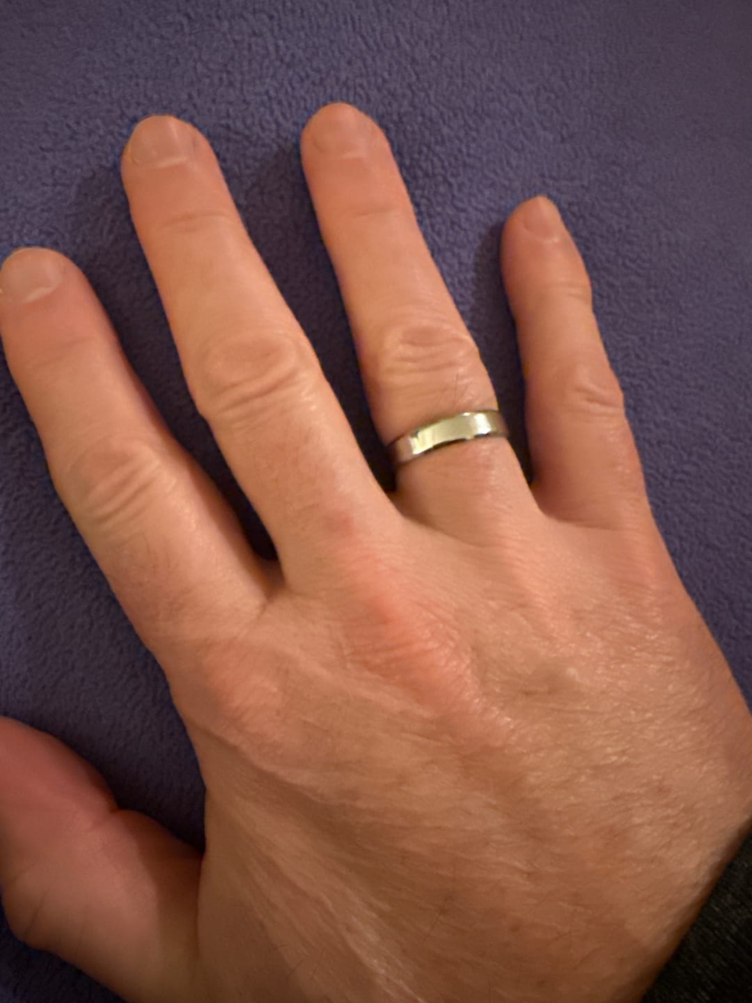 Customer photo review of Classic Unisize Ring