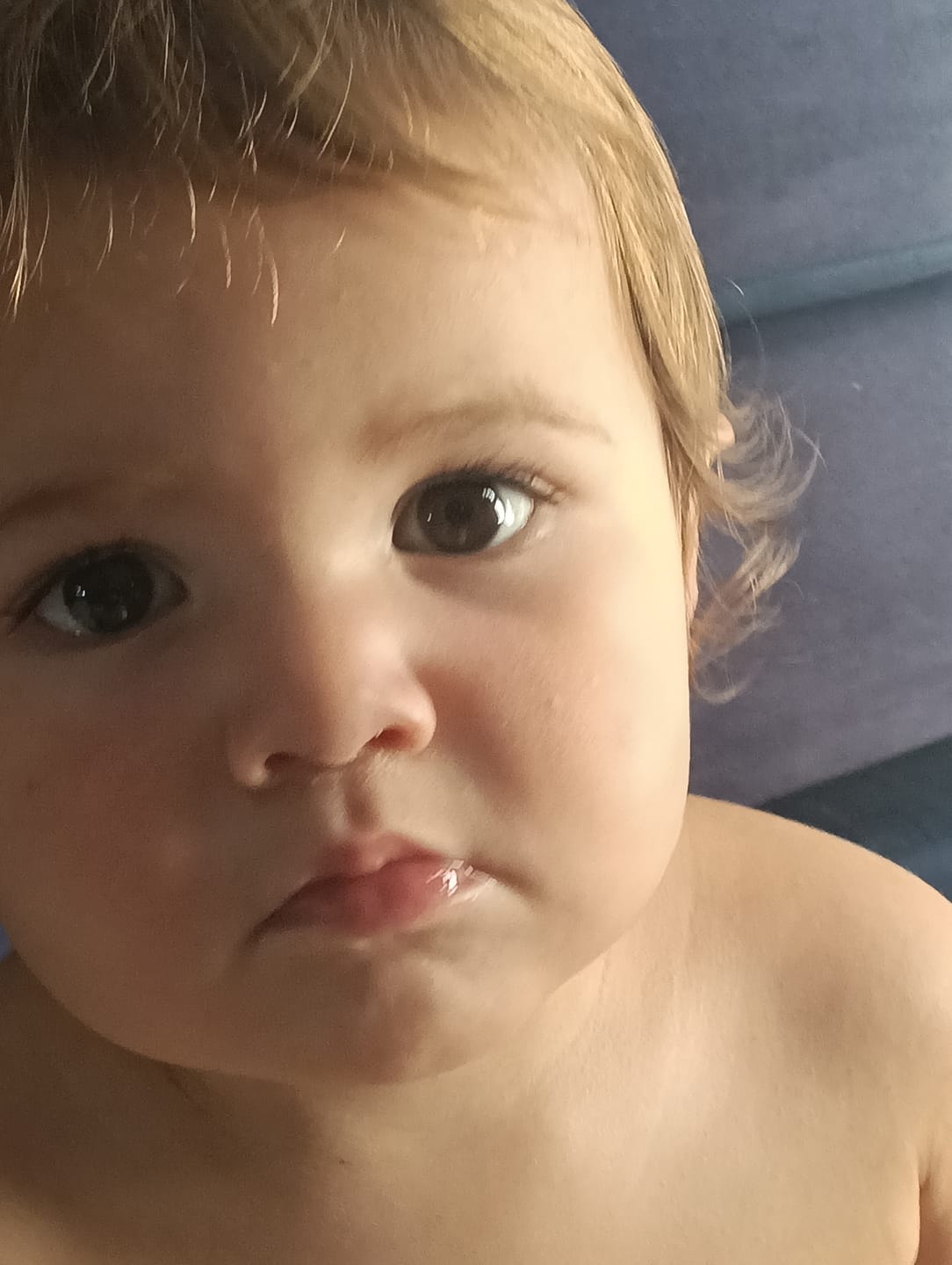 Customer photo review of Baby’s Dry Itchy Skin Care Manuka Bundle