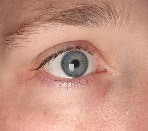 Reviewer's eye showing reduced dark circles after using Goji Berry Eye Cream.