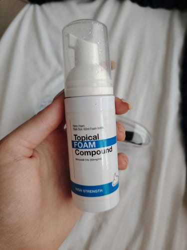 Customer photo review of Minoxidil High Strength (5%) FOAM, 3x60ml pack