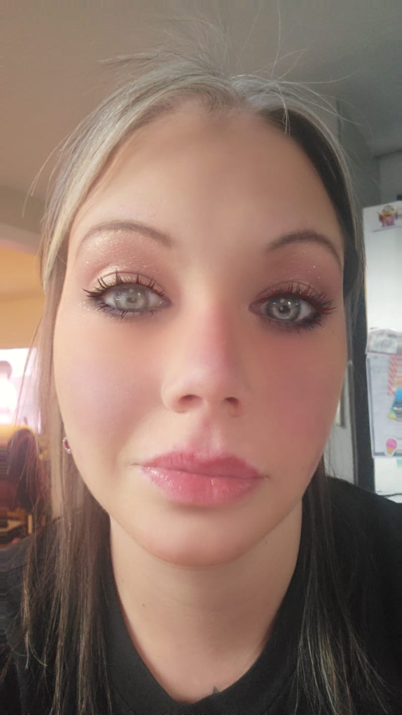 Customer photo review of Amazonia Icy Volcano Gray Prescription Colored Contact Lenses