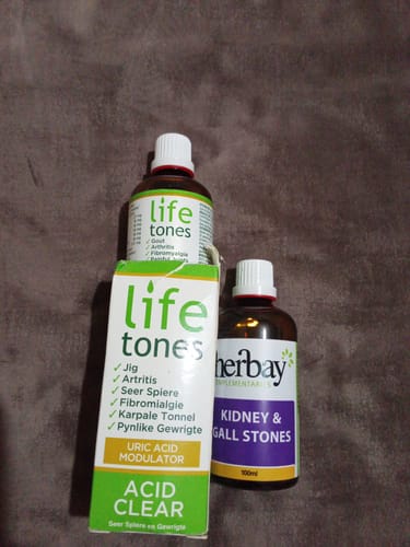 Customer photo review of Kidney & Gall Stones