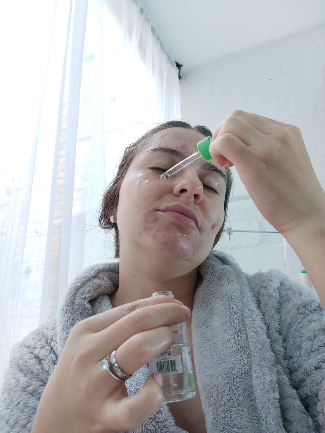 Customer photo review of Sérum facial con Aloe Vera