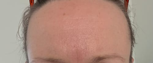 Customer photo review of The Complete System for Mature Women’s Skin