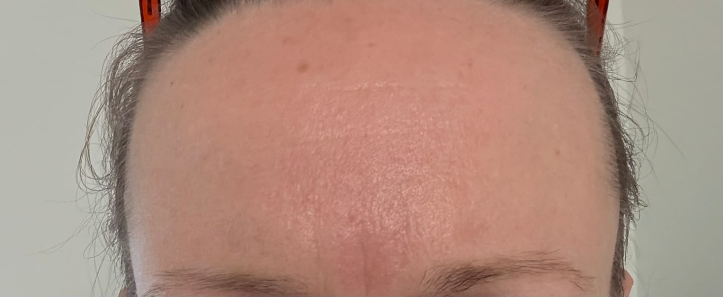 Customer photo review of The Complete System for Mature Women’s Skin