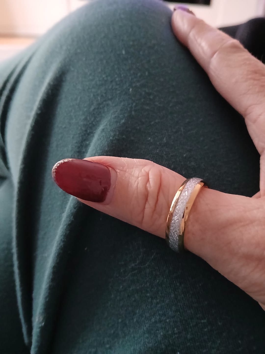 Customer photo review of The Golden Steel 6mm Wonder Ring