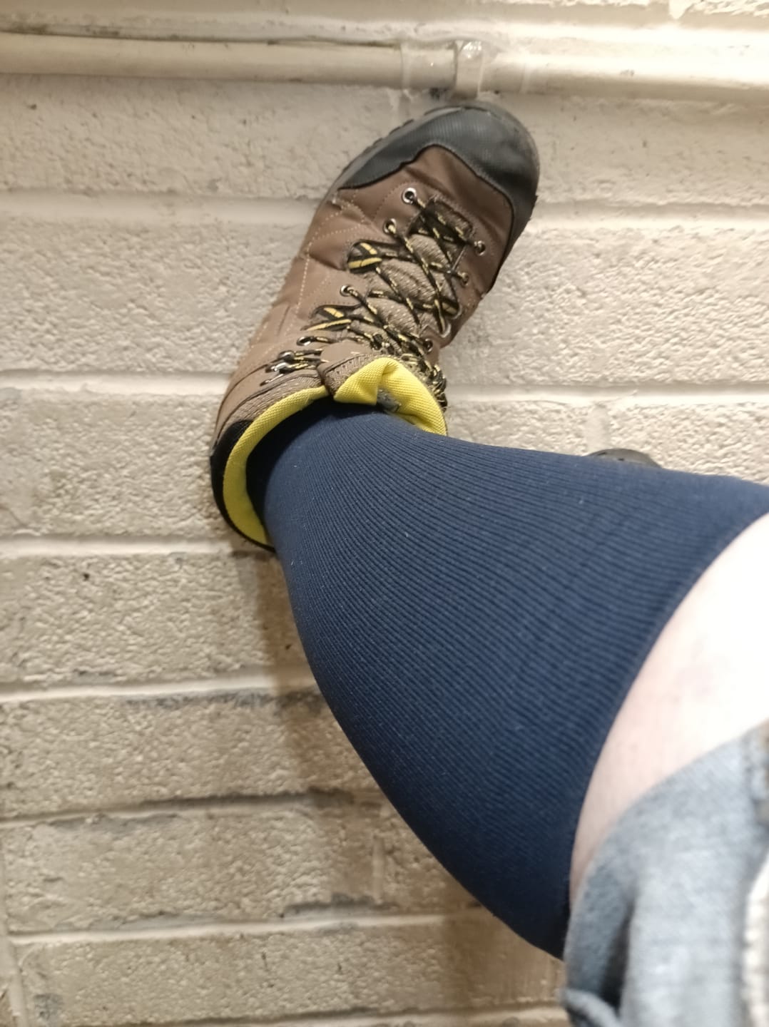 Customer photo review of The Step by Step Guide To Transforming Your Leg Health