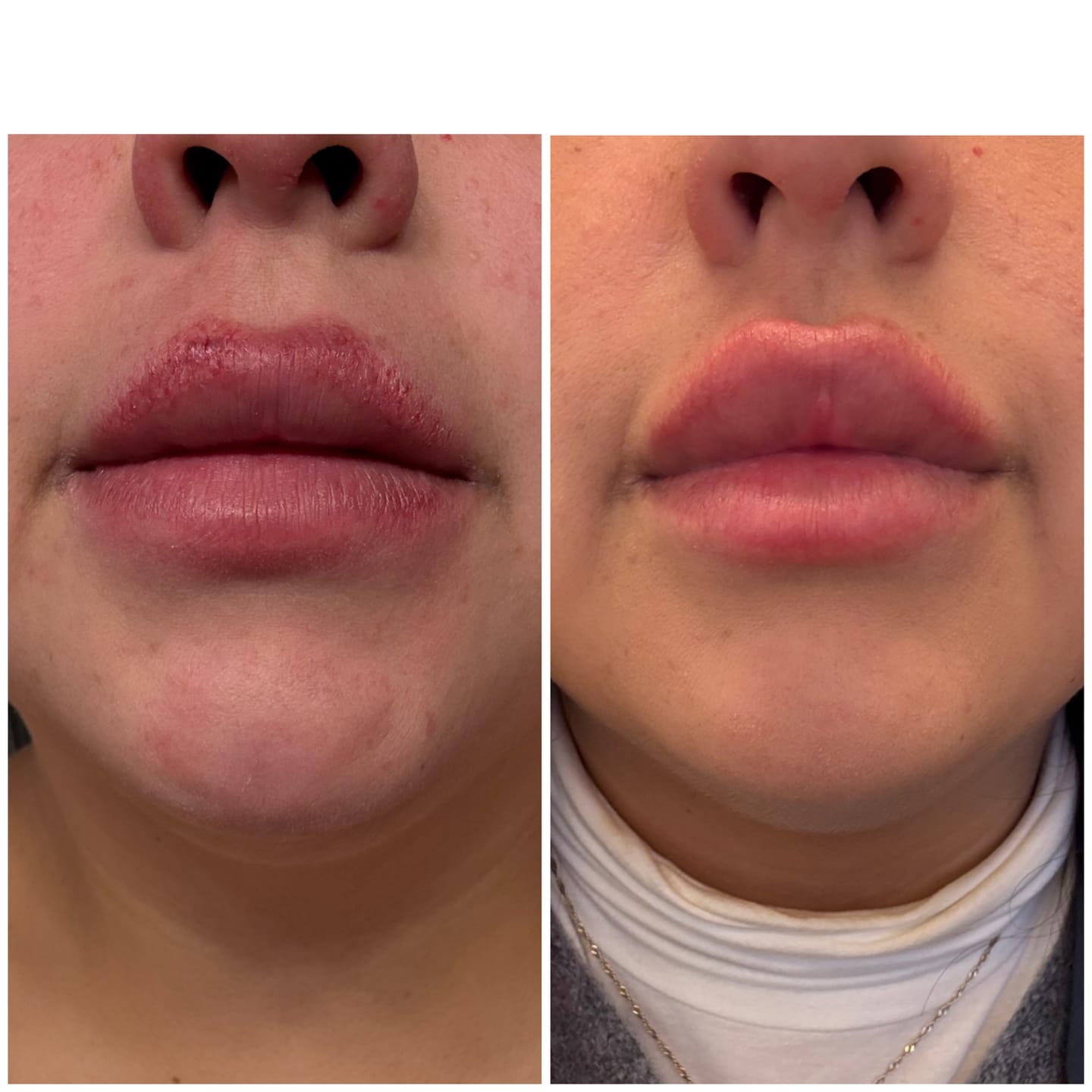 Customer photo review of Bioskin Zeoderm Skin Repair Moisturiser