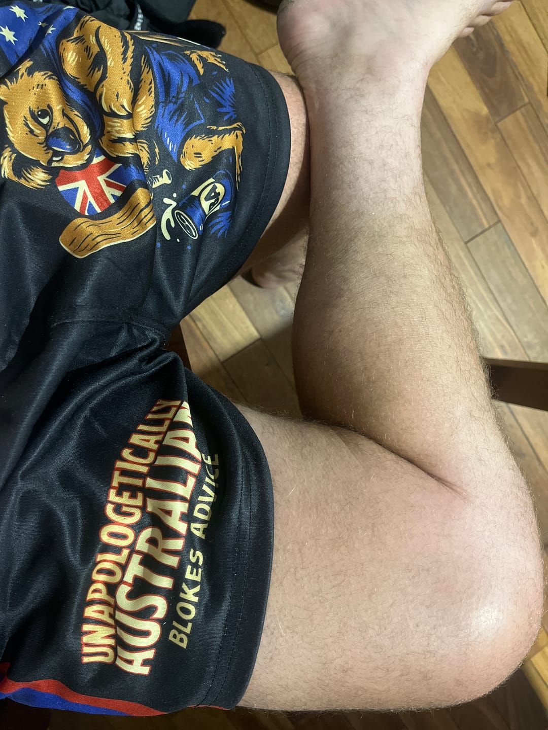 Customer photo review of Aussie As Footy Shorts