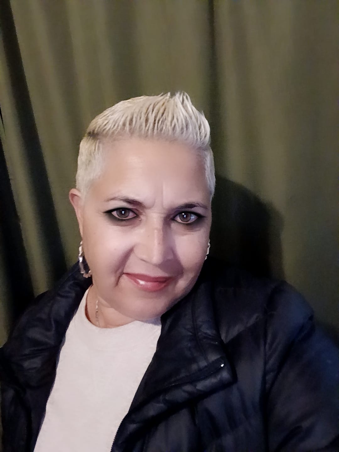 Customer photo review of Anti-Aging treatment