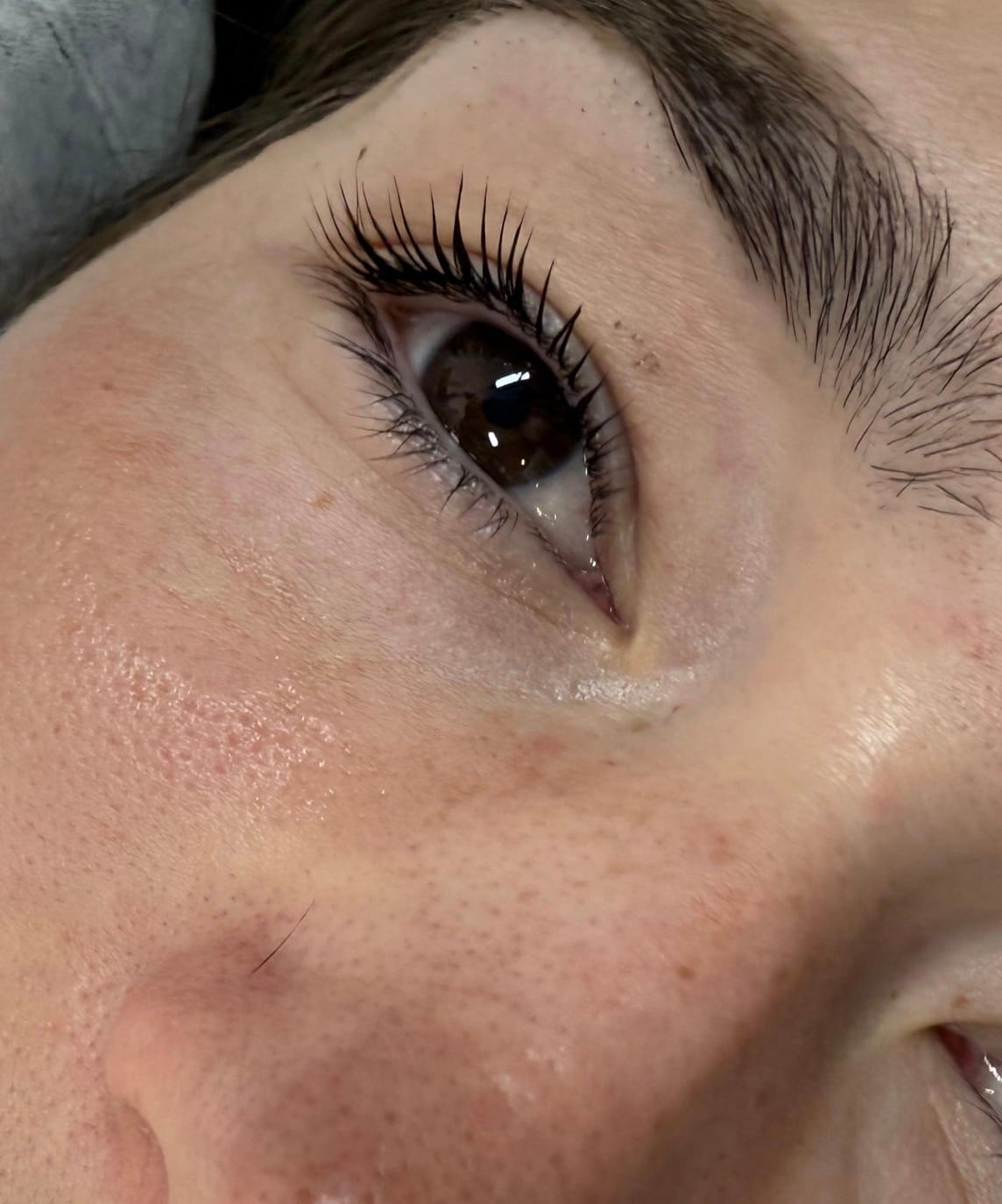 Customer photo review of Black Lash Serum