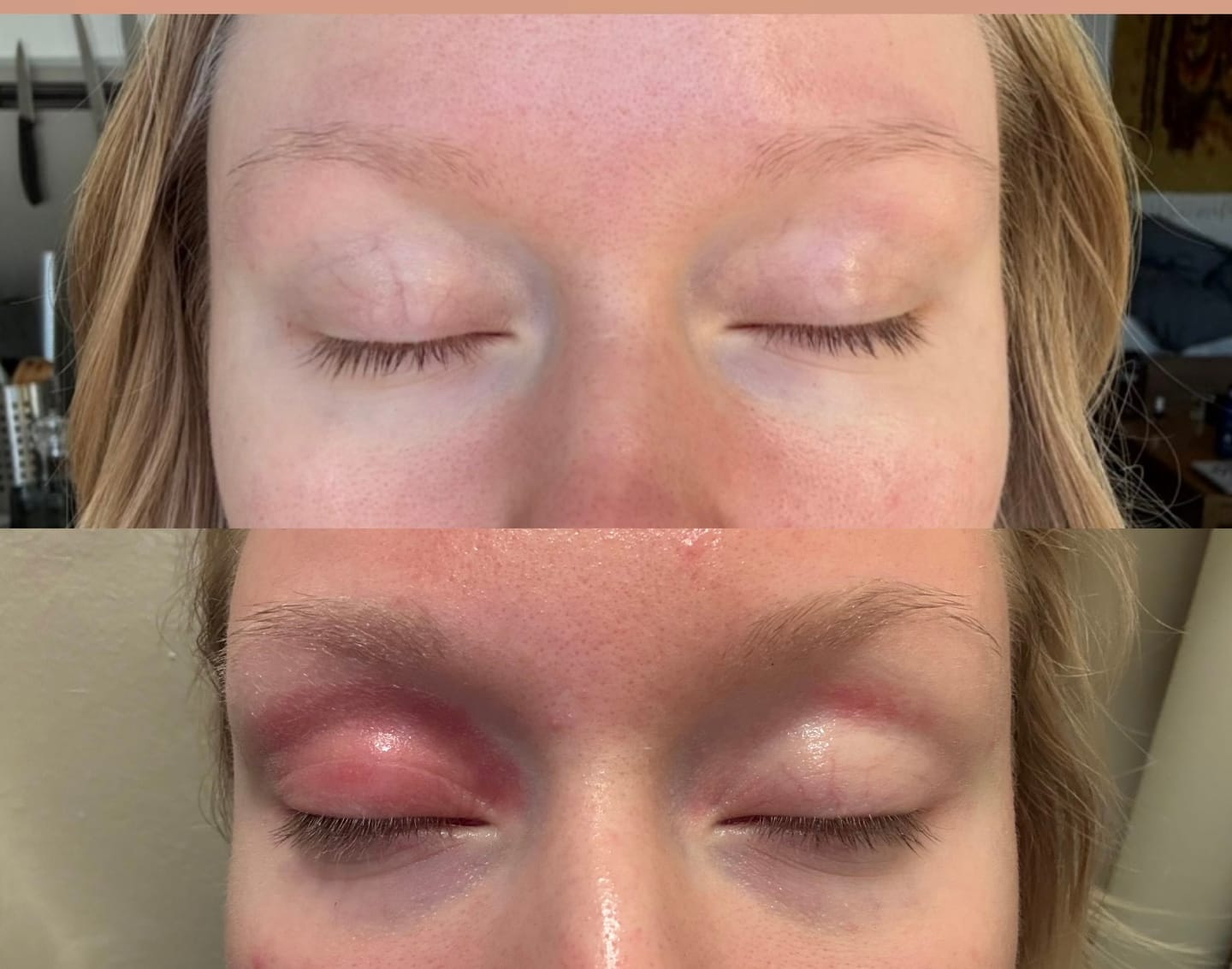 Customer photo review of Metsäbiomi Voidepala - 3 vaihtoehtoa