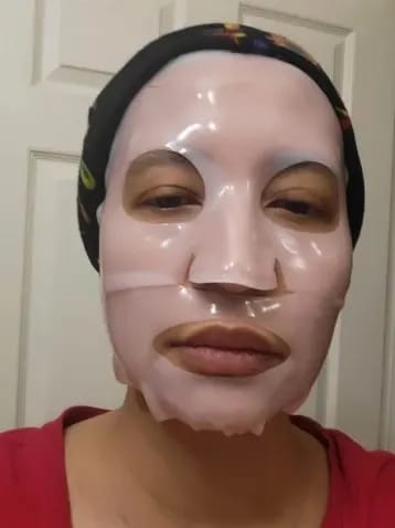 Customer photo review of LUMORA PDRN Renewal Infusion Mask