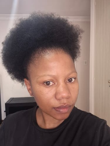 Customer photo review of New Formula: Scalp Serum Set