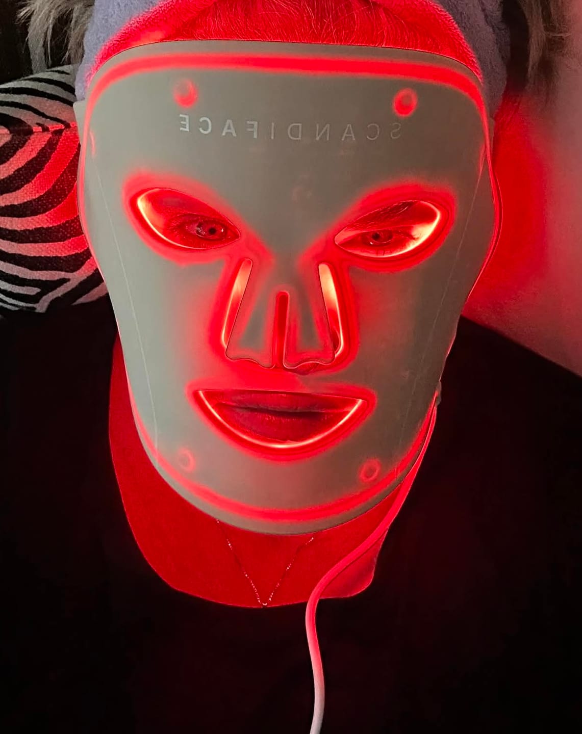 Customer photo review of Skinboosting LED mask