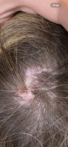 Customer photo review of Seb Natural Calming Serum