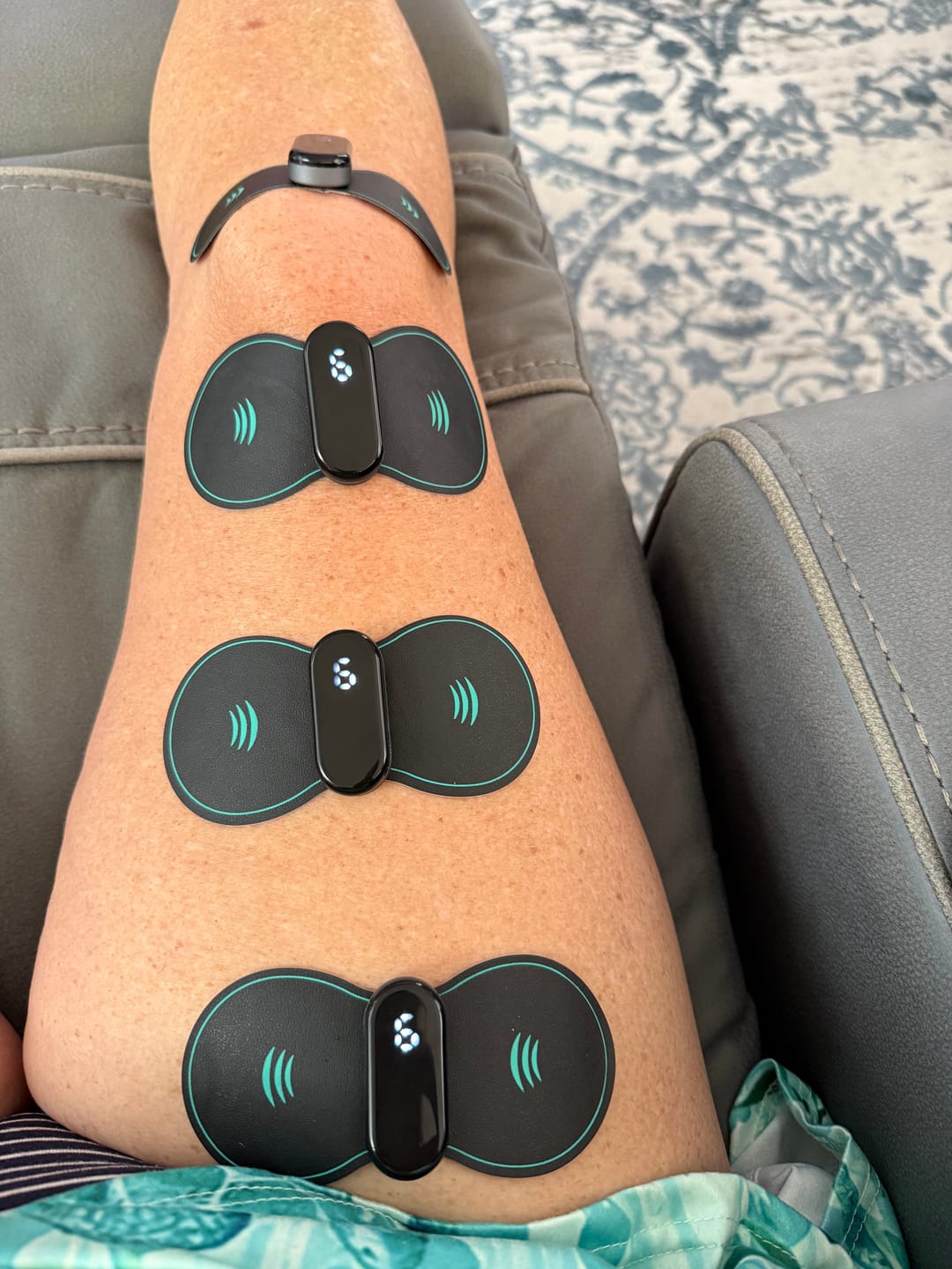 Customer photo review of Vibit TENS - Electrical Nerve Stimulation Therapy