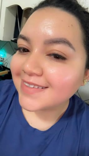 Customer photo review of LUMORA PDRN Renewal Infusion Mask