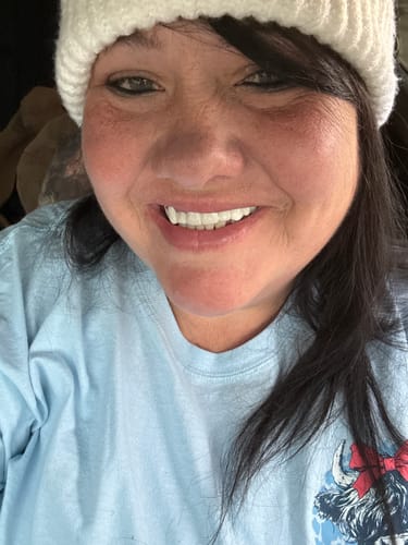 Customer in a white knit hat smiling to show off their new Spare Veneers.