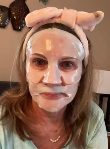 Customer photo review of LUMORA PDRN Renewal Infusion Mask