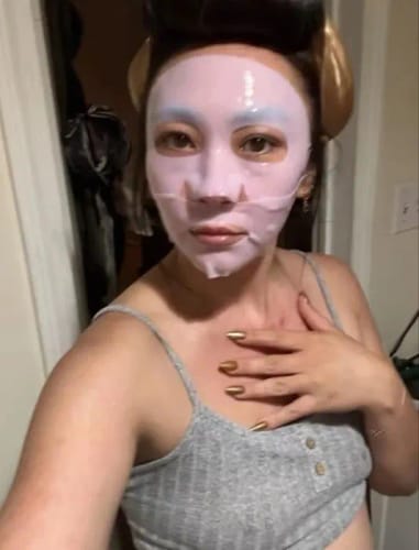 Customer photo review of LUMORA PDRN Renewal Infusion Mask
