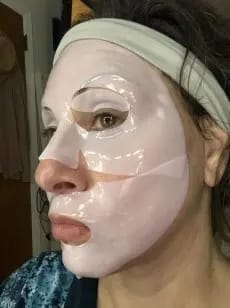 Customer photo review of LUMORA PDRN Renewal Infusion Mask