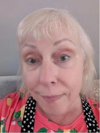 Customer photo review of LUMORA PDRN Renewal Infusion Mask