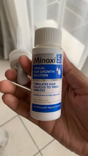 Customer photo review of Minoxidil 5% Solution, 1 Pack 60ml