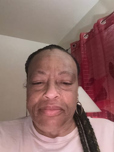 Customer's close-up photo showing their facial skin after using the Grass Fed Tallow & Honey Balm.