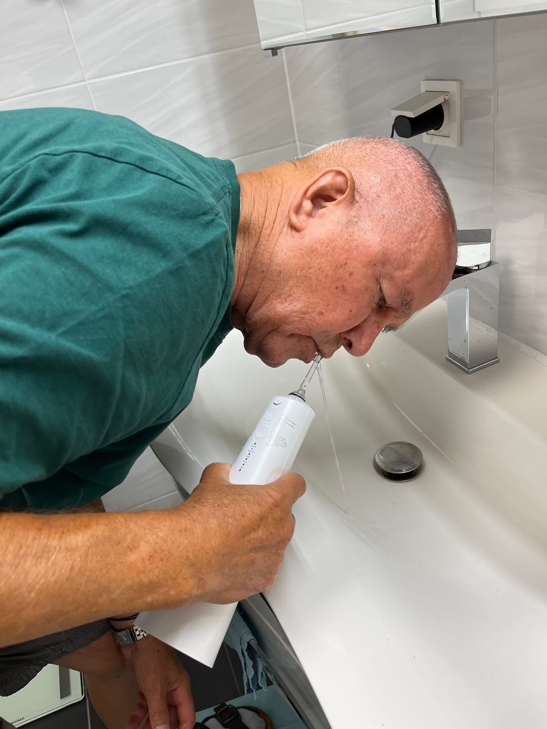 Customer photo review of Oryzom ProFlow 2.0 – Deep Cleaning for Teeth & Healthier Gums with Precision Water-Jet Technology
